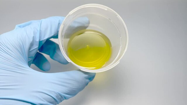 Urine sample in a medical container for biomaterials. Gloved doctor's hand holds a sterile container with light yellow colour urine. Very good urine sample of a healthy person. Medical analysis.