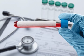 Blood sample tube for analysis Test. Blood tube test with requisition form