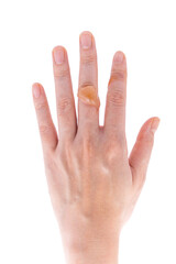 Close-up of the water blister on the finger on a white background.