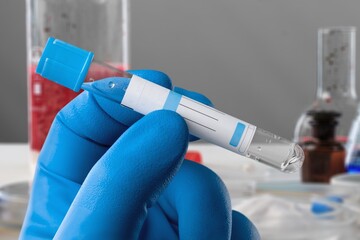 Blood test concept, genes that are important to fighting cancer