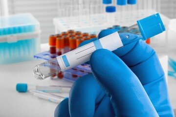 Blood test concept, genes that are important to fighting cancer