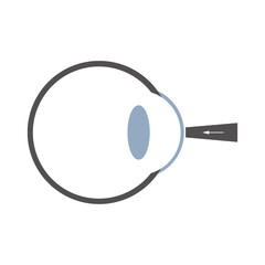 Grafische Darstellung einer Augeninnendruckmessung