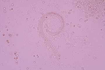 View in microscopic Strongyloides stercoralis or threadworm in human stool.Parasite...