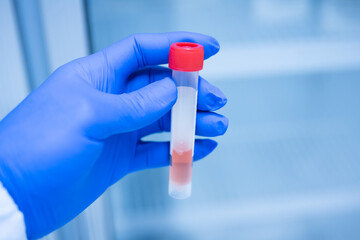 Close up scientist hand wearing blue gloves and holding storage reagent container for laboratory analysis.Scientist hand holding reagent tube during prepare specimen for auto machine analysis.