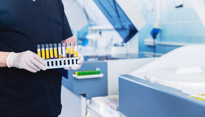 Scientist nurse downloads blood test samples to dna, hiv, aids, Coronavirus on automatic...