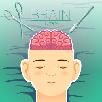 cartoon brain surgery vector illustration