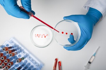 Lab scientist a rapid diagnostic test to detect presence of viral protein expressed by virus...