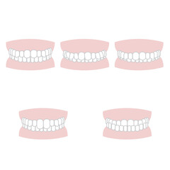 歯並び　イラスト