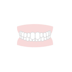 出っ歯　歯並び　イラスト