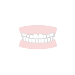 歯並び　イラスト　反対咬合