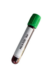 Blood sample for PO2(partial pressure of oxygen) and PCO2(partial pressure of carbon dioxide) test, ABG or Arterial Blood Gas. White background.