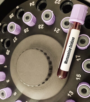 Blood sample for Monoamine oxidase (MAO) test, a class of antidepressants drug.