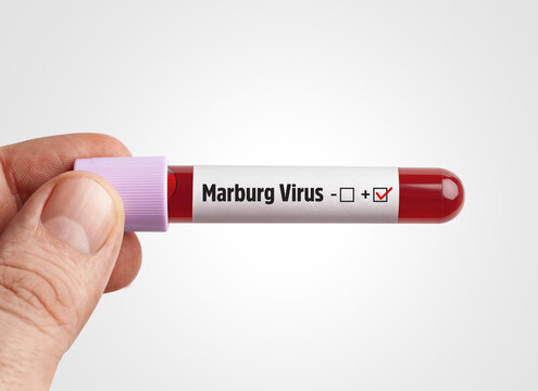 Marburg Virus concept: Scientist holding Marburg Virus (Mvd) infected blood in test tube on white background. 