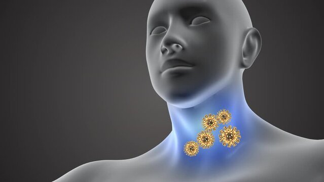 Human throat infected with corona virus