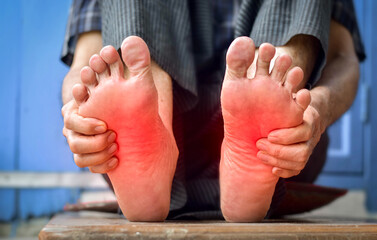 Tingling and burning sensation in feet of Asian man. Foot pain. Sensory neuropathy problems. Foot...