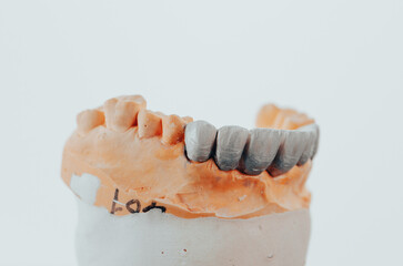 laboratory prepared zirconium teeth