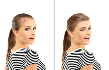 Thinning hair and hair loss,female pattern baldness,Hair transplant