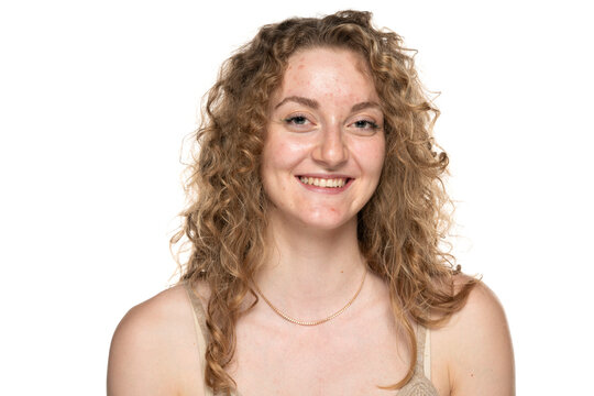 beautiful young blond women with long curly hair and problemati skin