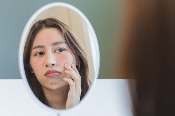 Asian young woman looking face skin in the mirror have a red rash on her face from cosmetic allergy