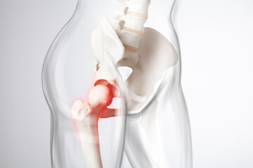 Hip bone pain - obrazy, fototapety, plakaty