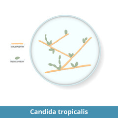 Candida tropicalis. Species of yeast in the genus Candida. A common pathogen in neutropenic hosts. Yeast visualization in Petri dish with blastoconidium and pseudohyphae.