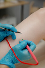 A woman on electroepilation of legs. Hardware permanent removal of unwanted hair in the salon.