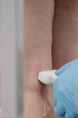 An orthopedic surgeon performs an ultrasound examination of the patient's leg veins in his office.