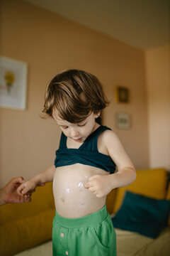 Boy with varichella 