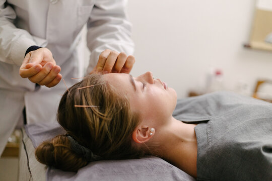 Acupuncture
