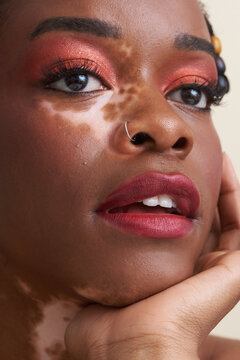 Dramatic Beauty Portrait of Black Woman with Vitiligo and Red Lipstick