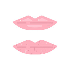 healthy lips and dry or chapped lips. lip health. health. flat cartoon illustration. vector concept design
