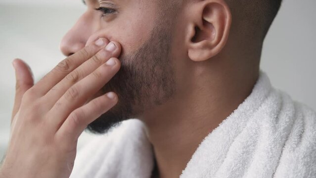 Acne treatment. Facial skincare. Problem skin moisturizing. Dermatology cosmetic product. Bearded man applying smearing serum on dry irritated face.