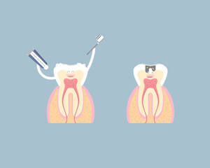 dental teeth care with tooth decay, cavity, caries, internal organs anatomy nervous system, periodontal, vector illustration cartoon flat design clip art