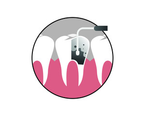 dental health concept. dental treatment. health vector graphic.
