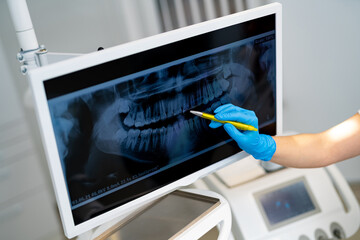 Modern digital radiology for stomatology. Teeth dentistry x ray examination.