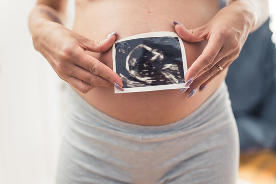 USG picture of a baby during pregnancy held by two hands with long sparkly nails of a caucasian person. Nude pregnant belly in the background. High quality photo