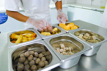 Hygiene Hand Serving Fried Food, Meatballs, and Snacks in Kitchen Factory
