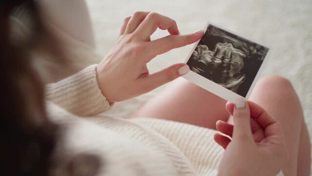 top view of a woman's pregnant belly and a photo of an ultrasound of a baby
