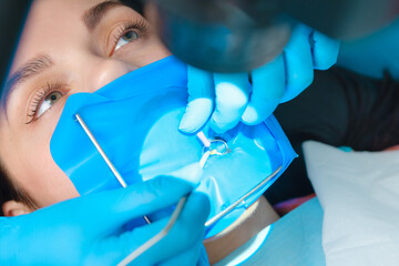 Photo endodontic treatment of dental canals