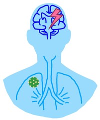 The illustration show the symbols of covid and stroke.