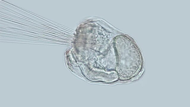 Larva mitraria of worm Polychaeta, of the Oweniidae family under microscope, is planktotrophic. Stays in the water column due to long cilia. White Sea