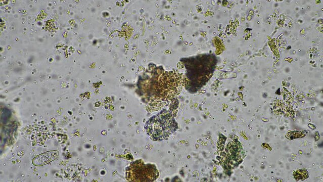 soil microbes organisms in a soil and compost sample, fungus and fungi and under the microscope in regenerative agriculture. in australia.