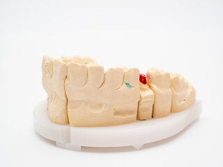 Plaster model or cast of human teeth.