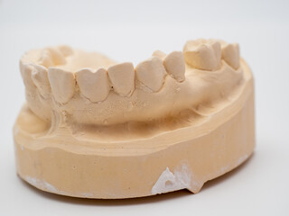 Plaster model or cast of human teeth.