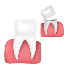Tooth anatomy medical banner. 3D Vector infographics. Dental poster. The diagram of a healthy tooth cut.