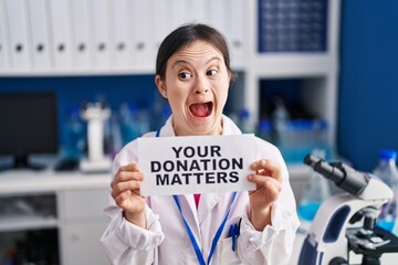 Woman with down syndrome working at scientist laboratory holding your donation matters banner...