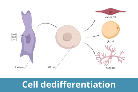 Cell dedifferentiation. Genes encoding three transcription regulators are artificially introduced into fibroblast nucleus, cell divides in culture (iPS cell), induced to de-differentiate.