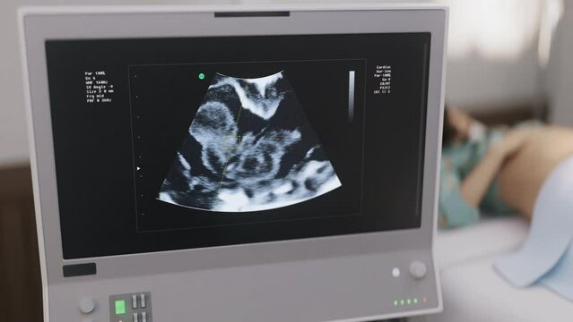 Hospital Prenatal Screening Procedure Investigates Health Condition Of Baby. Hospital Equipment. Child Heartbeat Screening Procedure. Screening Procedure By Hospital Scanner. Medical Test. Healthcare