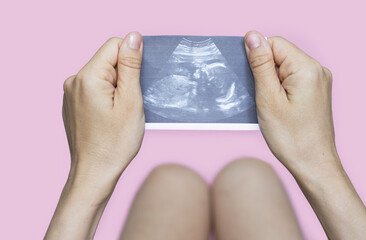 pregnancy and baby waiting concept. ultrasound picture with fetus in uterus in woman's hand,on pink...