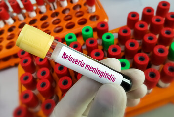 Blood sample for Neisseria meningitidis test, to diagnose Meningococcal disease. STDs - obrazy, fototapety, plakaty